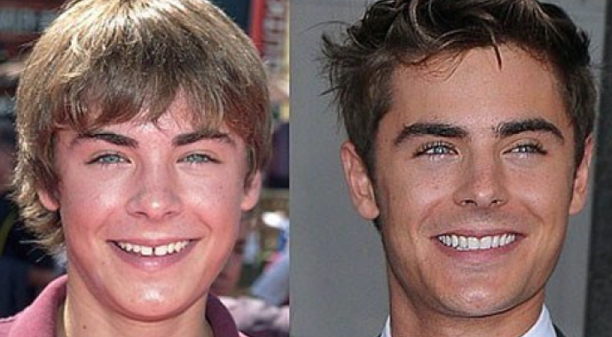 www.youngandstyle.fr zac efron