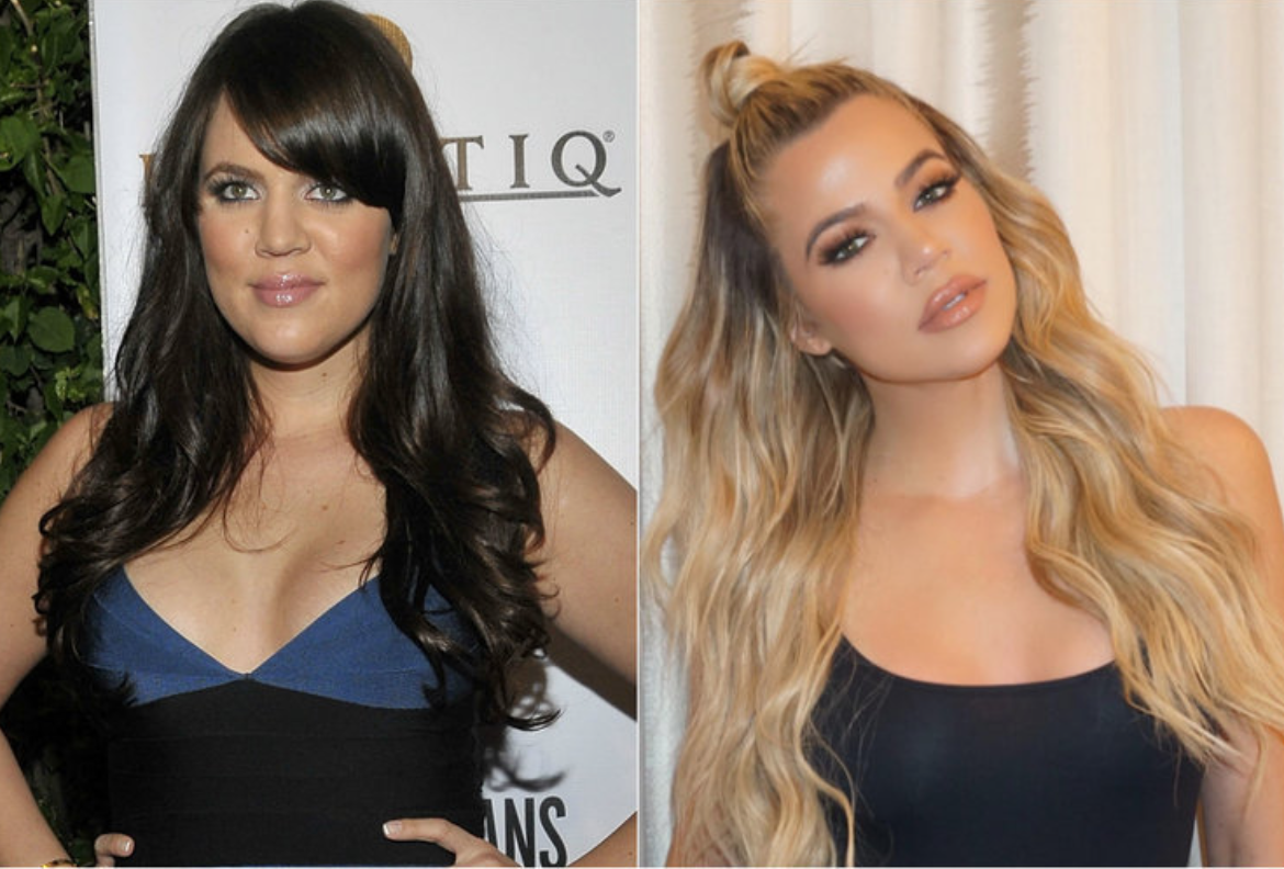 Kim, Kylie, Khloé … L’incroyable transformation des Kardashian 11