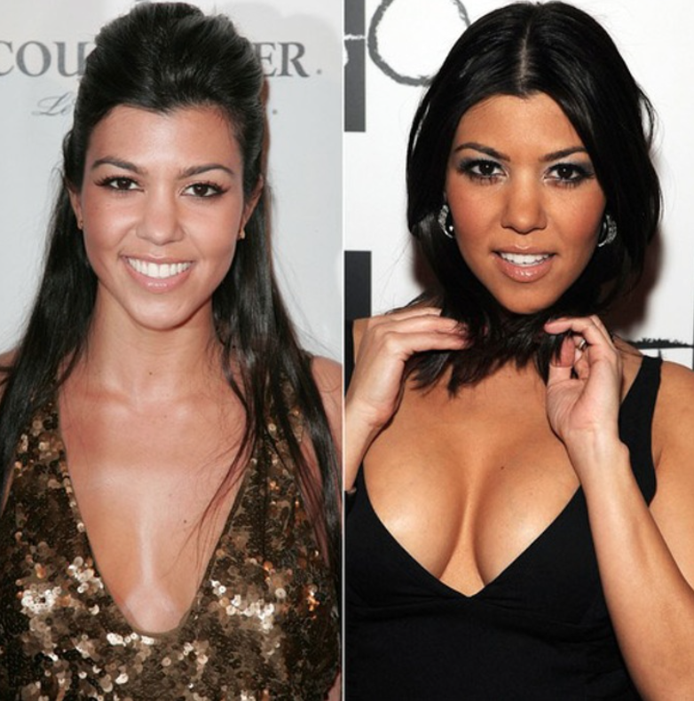 Kim, Kylie, Khloé … L’incroyable transformation des Kardashian 16