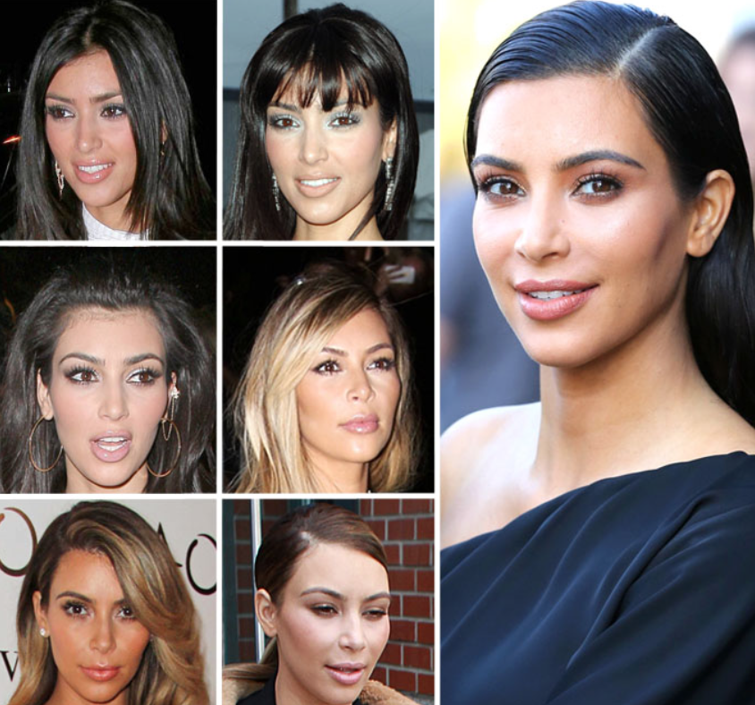 Kim, Kylie, Khloé … L’incroyable transformation des Kardashian 20