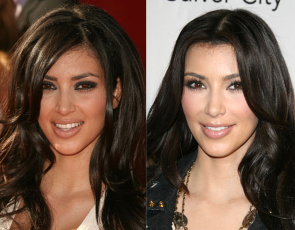 Kim, Kylie, Khloé … L’incroyable transformation des Kardashian 23