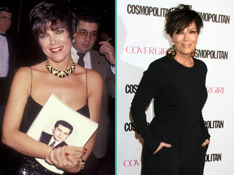 Kim, Kylie, Khloé … L’incroyable transformation des Kardashian 25
