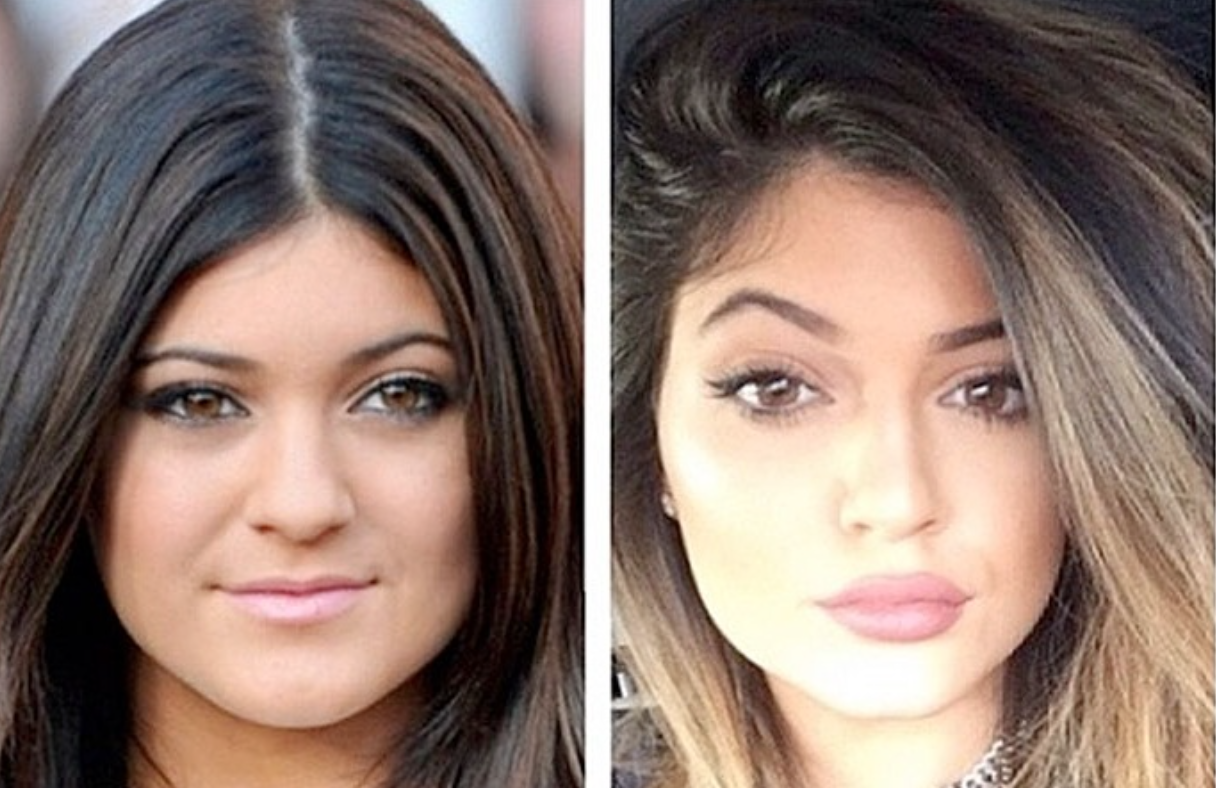 Kim, Kylie, Khloé … L’incroyable transformation des Kardashian 3