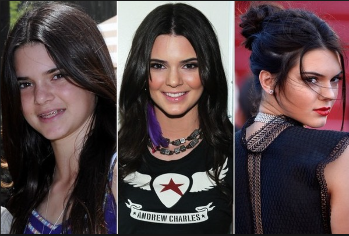 Kim, Kylie, Khloé … L’incroyable transformation des Kardashian 7
