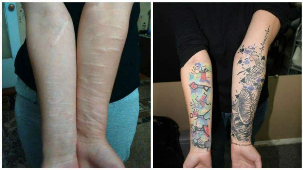 RÃ©sultat de recherche d'images pour "cicatrice cachÃ©e par tatouage"